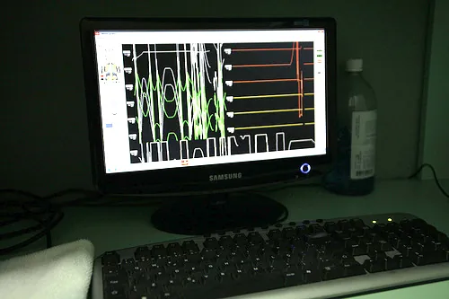 Monitor de eletroencefalograma